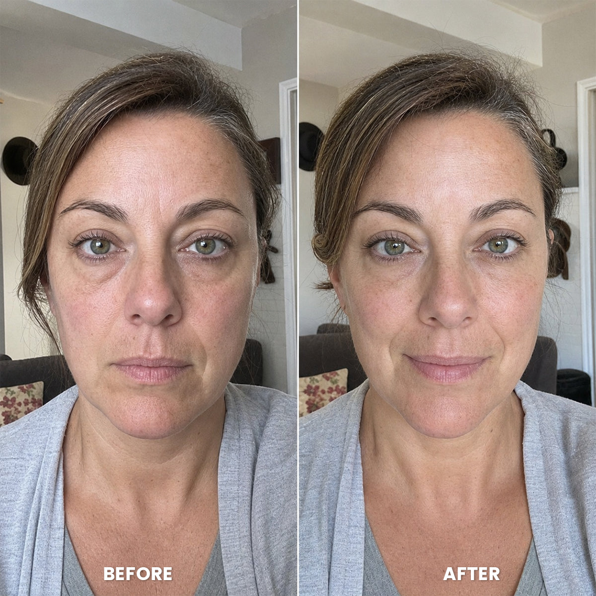 Before and after under-eye shadow