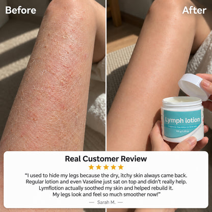 Fragrance-Free Non-Greasy Anti-Itch Ceramide NP Leg Lotion For Dry, Red, Sensitive, Discolored, Weeping