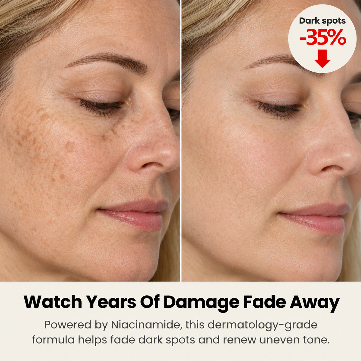Uneven skin tone skincare feature