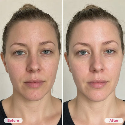 Pore Tightening Toner Pad