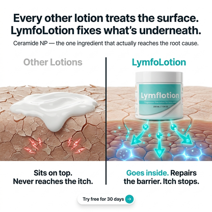 Fragrance-Free Non-Greasy Anti-Itch Ceramide NP Leg Lotion For Dry, Red, Sensitive, Discolored, Weeping