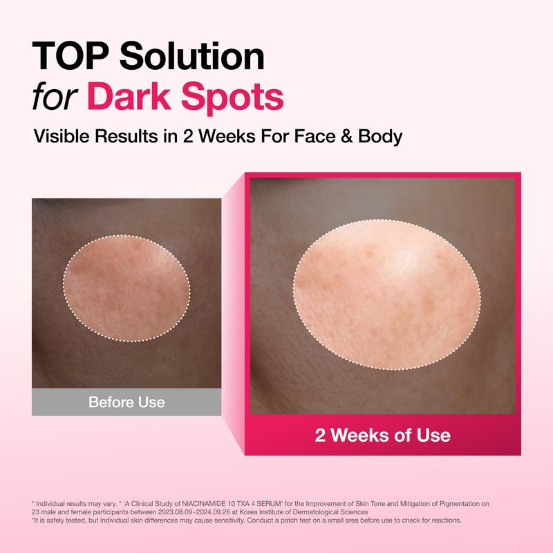 Niacinamide 10 TXA 4 Serum for Brightening and Dark Spots