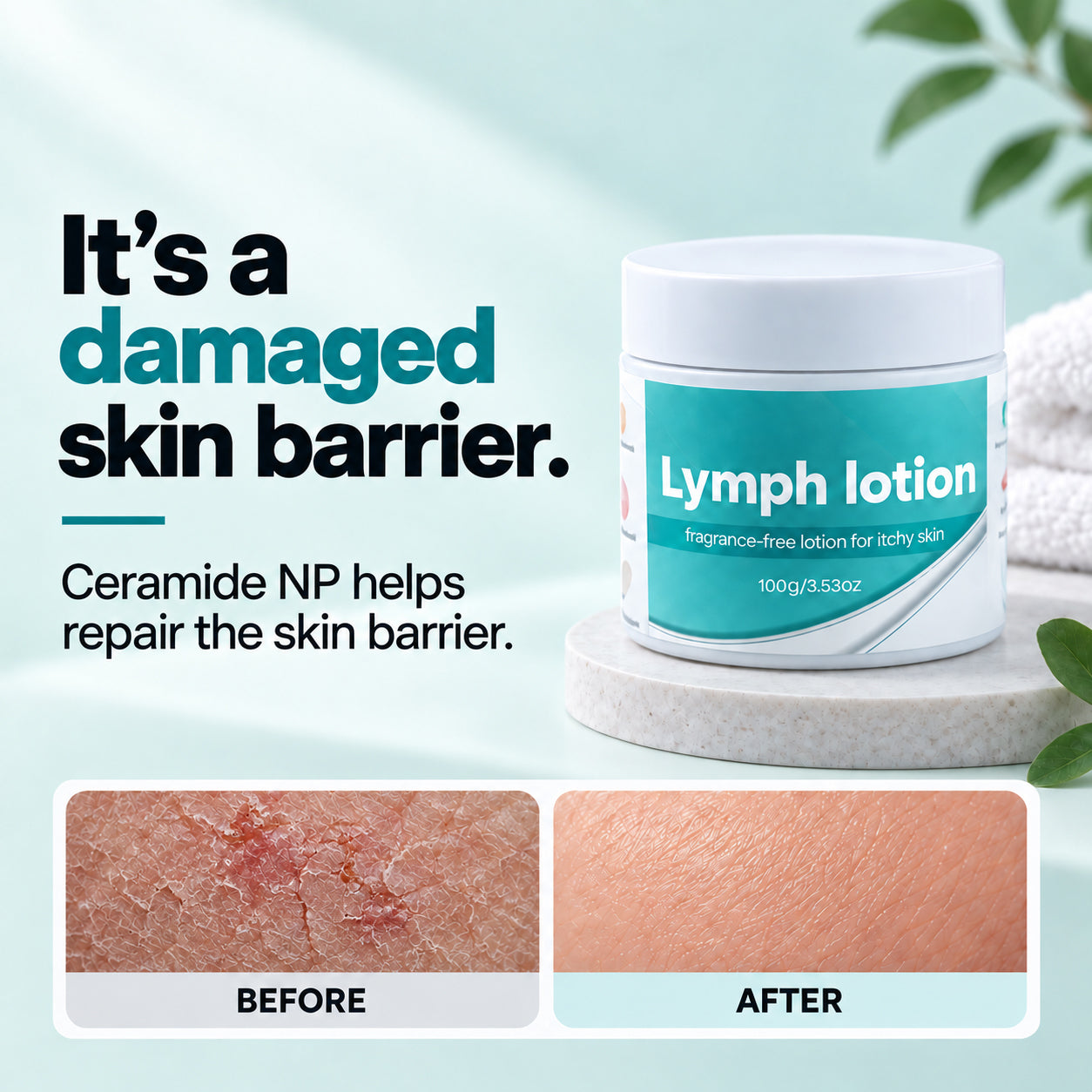Fragrance-Free Non-Greasy Anti-Itch Ceramide NP Leg Lotion For Dry, Red, Sensitive, Discolored, Weeping