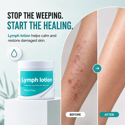 Fragrance-Free Non-Greasy Anti-Itch Ceramide NP Leg Lotion For Dry, Red, Sensitive, Discolored, Weeping