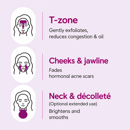 Arbutin 7% + Tranexamic Acid 4% Cream