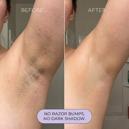 purelums Hair Removal Mousse