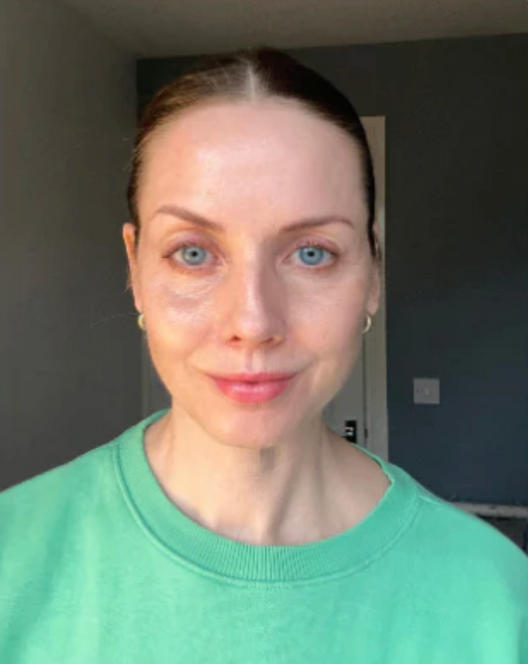 Viridifex Light foundation shade shown on a model
