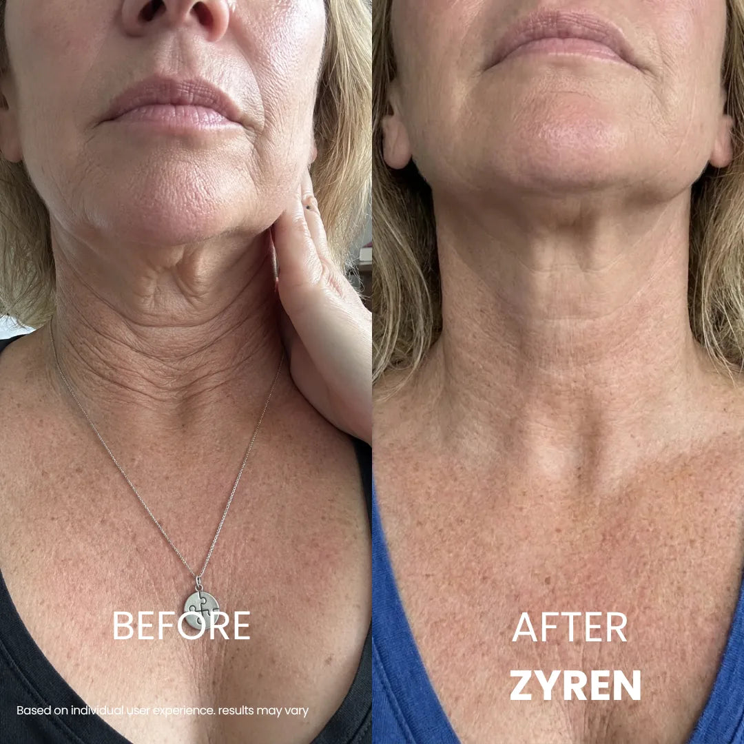 ca0fd166fa65a16e93.webp
