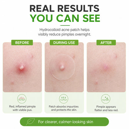 Zero Fit Blemish & Dark Spot Patch Duo