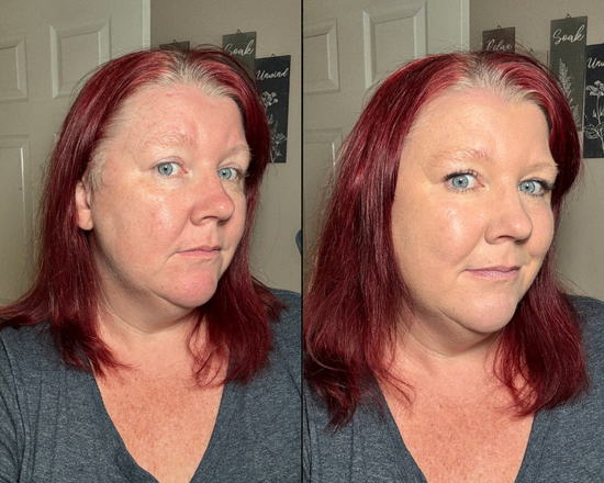 derma_before_after_3.png