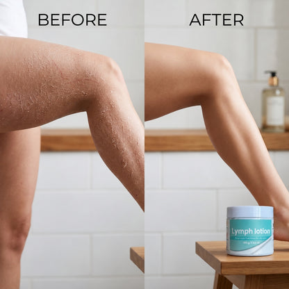 Fragrance-Free Non-Greasy Anti-Itch Ceramide NP Leg Lotion For Dry, Red, Sensitive, Discolored, Weeping
