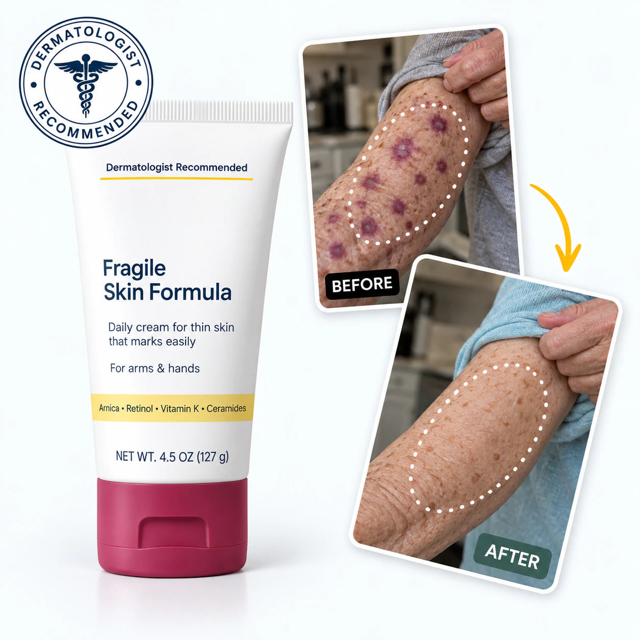  lookscene  Fragile Skin Formula with before-and-after forearm imagery
